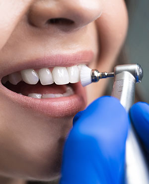 Dental Cleanings Near Me Serving Bay Area, San Jose, CA 