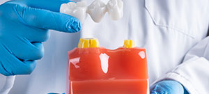 Types of Dental Bridges Near Me Serving Bay Area, San Jose, CA Types of Dental Bridges Near Me Serving Bay Area, San Jose, CA