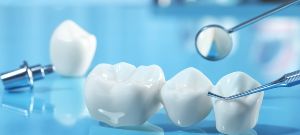 Is Dental Crowns Covered by Insurance Near Me in Bay Area San Jose CA Is Dental Crowns Covered by Insurance Near Me in Bay Area San Jose CA