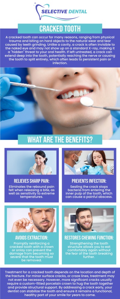 Common questions asked by patients: How much does cracked tooth repair cost? Does insurance cover a broken tooth? Can a dentist pull a fractured tooth? Cracked Tooth is a dental condition characterized by symptoms of sharp pain on chewing which is actually caused by a 'hidden' crack of the tooth. Visit Selective Dental today to learn more. For more information, contact us today or schedule an appointment online. We are conveniently located at 3151 South White Road, Suite 203 San Jose, CA 95148. We serve patients from all over Santa Clara County CA: San Jose, Milpitas, Santa Clara, Campbell, Sunnyvale, Cupertino, Saratoga, Los Gatos, and beyond! Common questions asked by patients: How much does cracked tooth repair cost? Does insurance cover a broken tooth? Can a dentist pull a fractured tooth?
Cracked Tooth is a dental condition characterized by symptoms of sharp pain on chewing which is actually caused by a 'hidden' crack of the tooth. Visit Selective Dental today to learn more. For more information, contact us today or schedule an appointment online. We are conveniently located at 3151 South White Road, Suite 203 San Jose, CA 95148. We serve patients from all over Santa Clara County CA: San Jose, Milpitas, Santa Clara, Campbell, Sunnyvale, Cupertino, Saratoga, Los Gatos, and beyond!
