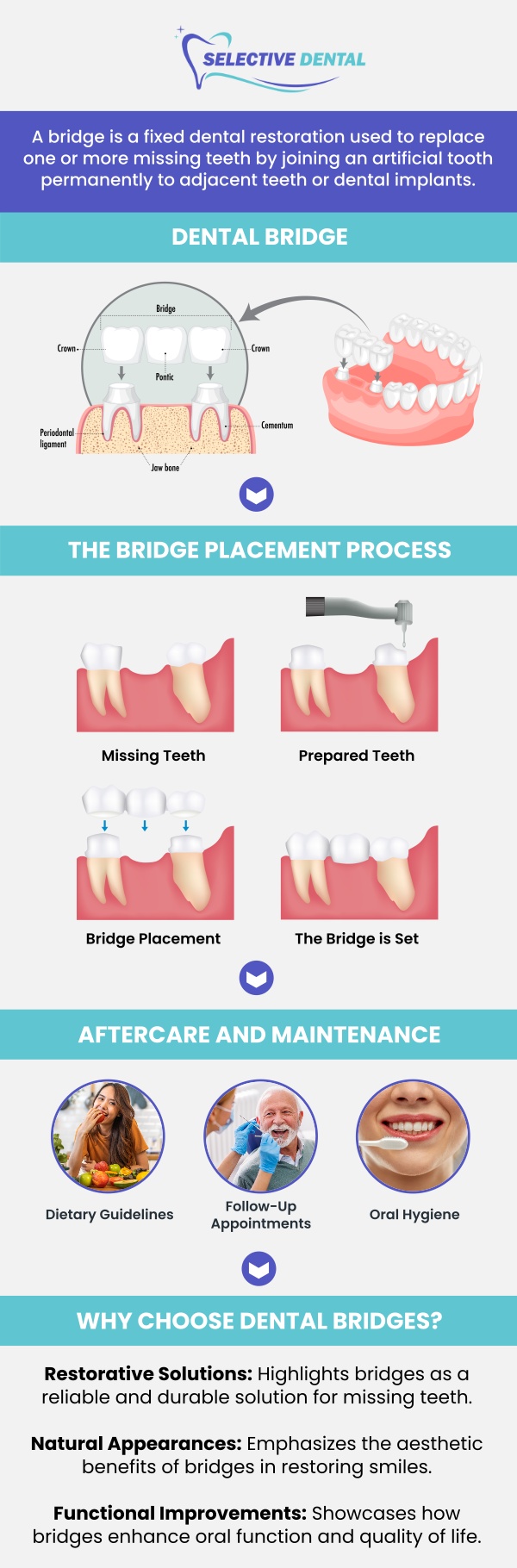 Dental bridges can help restore chewing function, improve the appearance of the smile, and support proper spacing between remaining teeth. At Selective Dental, Dr. Victoria Vuong, DDS, and our team evaluate the condition of the supporting teeth, gums, bite, and missing-tooth area before recommending treatment. This personalized approach helps determine whether a dental bridge is appropriate and allows patients to better understand the treatment process, expected costs, and available financing options before moving forward. Contact us today for more information or schedule an appointment online. We are conveniently located at 3151 South White Road, Suite 203 San Jose, CA 95148. Dental bridges can help restore chewing function, improve the appearance of the smile, and support proper spacing between remaining teeth. At Selective Dental, Dr. Victoria Vuong, DDS, and our team evaluate the condition of the supporting teeth, gums, bite, and missing-tooth area before recommending treatment. This personalized approach helps determine whether a dental bridge is appropriate and allows patients to better understand the treatment process, expected costs, and available financing options before moving forward. Contact us today for more information or schedule an appointment online. We are conveniently located at 3151 South White Road, Suite 203 San Jose, CA 95148.