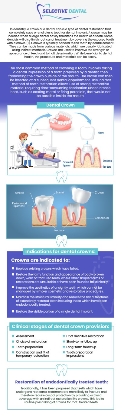 At Selective Dental, Dr. Victoria Vuong, DDS, offers dental crowns without insurance, typically ranging from $800 to $1,500 per tooth. The cost depends on factors like material and complexity. We provide flexible payment plans and financing options to make the treatment more accessible. Visit us today for a personalized estimate. Contact us today or schedule an appointment online! We are conveniently located at 3151 South White Road, Suite 203 San Jose, CA 95148. At Selective Dental, Dr. Victoria Vuong, DDS, offers dental crowns without insurance, typically ranging from $800 to $1,500 per tooth. The cost depends on factors like material and complexity. We provide flexible payment plans and financing options to make the treatment more accessible. Visit us today for a personalized estimate. Contact us today or schedule an appointment online! We are conveniently located at 3151 South White Road, Suite 203 San Jose, CA 95148.