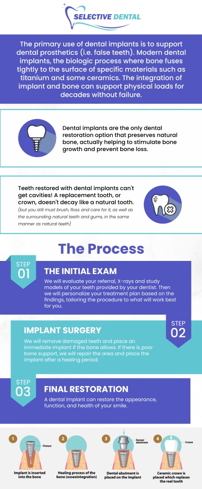 Dental implants are a highly effective solution for replacing missing teeth caused by decay, injury, or gum disease. This treatment not only improves the appearance of your smile but also restores functionality and supports long-term oral health. At Selective Dental, Dr. Victoria Vuong, DDS, provides personalized, high-quality care to ensure that each patient achieves the best possible outcome. With advanced technology and a commitment to patient comfort, we make your dental implant experience smooth and successful. Contact us today for more information or schedule an appointment online. We are conveniently located at 3151 South White Road, Suite 203 San Jose, CA 95148. Dental implants are a highly effective solution for replacing missing teeth caused by decay, injury, or gum disease. This treatment not only improves the appearance of your smile but also restores functionality and supports long-term oral health. At Selective Dental, Dr. Victoria Vuong, DDS, provides personalized, high-quality care to ensure that each patient achieves the best possible outcome. With advanced technology and a commitment to patient comfort, we make your dental implant experience smooth and successful. Contact us today for more information or schedule an appointment online. We are conveniently located at 3151 South White Road, Suite 203 San Jose, CA 95148.