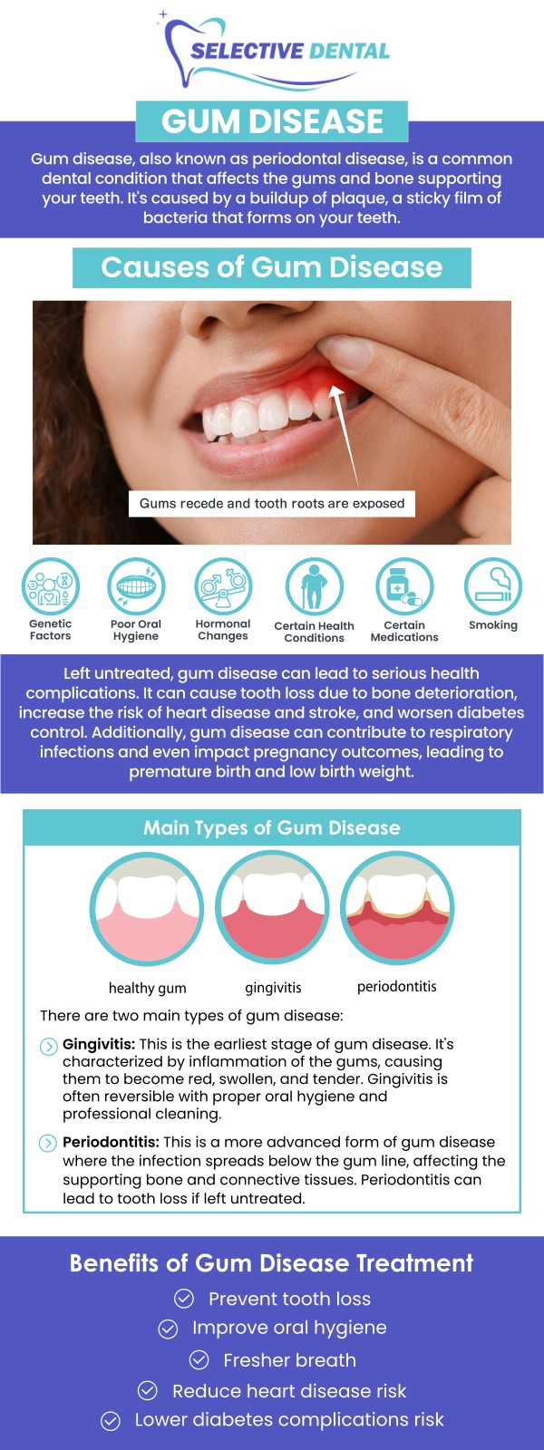 Gum disease is a common oral health condition caused by plaque and bacteria building up around the teeth and along the gumline. Common signs may include red, swollen, or tender gums, bleeding while brushing or flossing, persistent bad breath, gum recession, tooth sensitivity, or loose teeth in more advanced cases. At Selective Dental, Dr. Victoria Vuong, DDS, provides personalized evaluation and gum disease care based on each patient’s symptoms and oral health needs. Treatment may help control inflammation, reduce harmful bacterial buildup, improve gum health, and protect the tissues and bone that support the teeth. If you are looking for a Gum Disease Dentist in the Bay Area, our team in San Jose, CA, can help identify possible causes, explain treatment options, and support healthier gums and a stronger smile. Contact us today or schedule an appointment online. We are conveniently located at 3151 South White Road, Suite 203 San Jose, CA 95148. Gum disease is a common oral health condition caused by plaque and bacteria building up around the teeth and along the gumline. Common signs may include red, swollen, or tender gums, bleeding while brushing or flossing, persistent bad breath, gum recession, tooth sensitivity, or loose teeth in more advanced cases. At Selective Dental, Dr. Victoria Vuong, DDS, provides personalized evaluation and gum disease care based on each patient’s symptoms and oral health needs. Treatment may help control inflammation, reduce harmful bacterial buildup, improve gum health, and protect the tissues and bone that support the teeth. If you are looking for a Gum Disease Dentist in the Bay Area, our team in San Jose, CA, can help identify possible causes, explain treatment options, and support healthier gums and a stronger smile. Contact us today or schedule an appointment online. We are conveniently located at 3151 South White Road, Suite 203 San Jose, CA 95148.