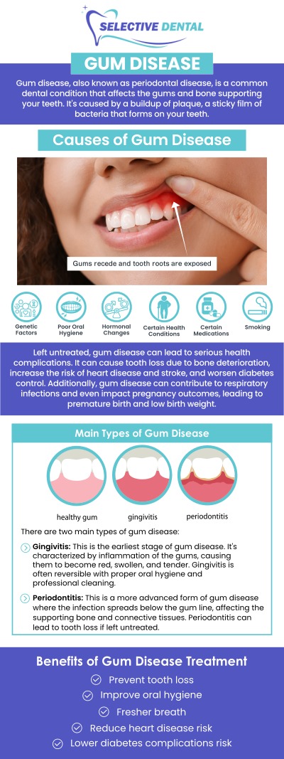 Gum disease is a common oral health condition caused by plaque and bacteria building up around the teeth and along the gumline. Common signs may include red, swollen, or tender gums, bleeding while brushing or flossing, persistent bad breath, gum recession, tooth sensitivity, or loose teeth in more advanced cases. At Selective Dental, Dr. Victoria Vuong, DDS, provides personalized evaluation and gum disease care based on each patient’s symptoms and oral health needs. Treatment may help control inflammation, reduce harmful bacterial buildup, improve gum health, and protect the tissues and bone that support the teeth. If you are looking for a Gum Disease Dentist in the Bay Area, our team in San Jose, CA, can help identify possible causes, explain treatment options, and support healthier gums and a stronger smile. Contact us today or schedule an appointment online. We are conveniently located at 3151 South White Road, Suite 203 San Jose, CA 95148. Gum disease is a common oral health condition caused by plaque and bacteria building up around the teeth and along the gumline. Common signs may include red, swollen, or tender gums, bleeding while brushing or flossing, persistent bad breath, gum recession, tooth sensitivity, or loose teeth in more advanced cases. At Selective Dental, Dr. Victoria Vuong, DDS, provides personalized evaluation and gum disease care based on each patient’s symptoms and oral health needs. Treatment may help control inflammation, reduce harmful bacterial buildup, improve gum health, and protect the tissues and bone that support the teeth. If you are looking for a Gum Disease Dentist in the Bay Area, our team in San Jose, CA, can help identify possible causes, explain treatment options, and support healthier gums and a stronger smile. Contact us today or schedule an appointment online. We are conveniently located at 3151 South White Road, Suite 203 San Jose, CA 95148.