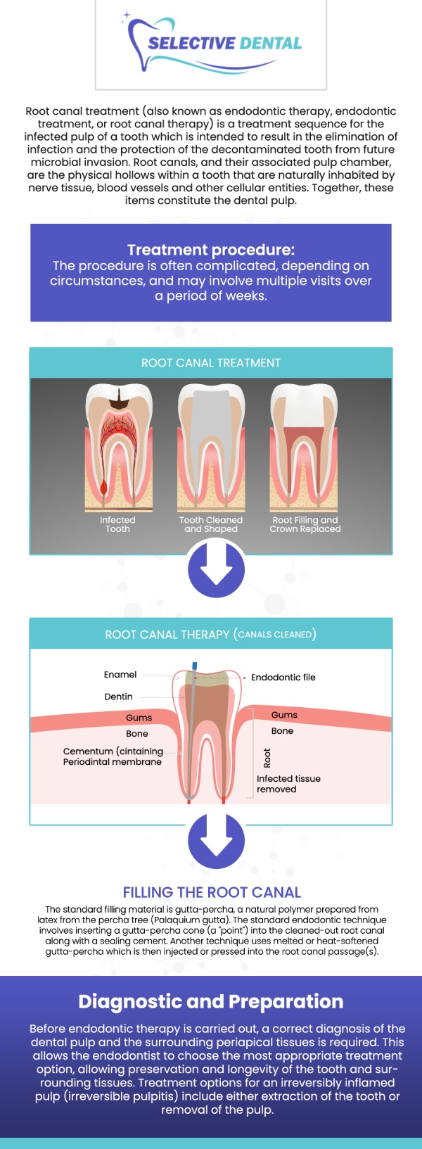 Common Questions Asked by Patients: Is it painful to get a root canal? Is a root canal a serious procedure? What happens during a root canal? A root canal treatment becomes necessary when there is inflammation or infection in the pulp chamber of a tooth. Visit Selective Dental to get quality and expert care. For more information, contact us today or schedule an appointment online. We are conveniently located at 3151 South White Road, Suite 203 San Jose, CA 95148. We serve patients from all over Santa Clara County CA: San Jose, Milpitas, Santa Clara, Campbell, Sunnyvale, Cupertino, Saratoga, Los Gatos CA, and beyond! Common Questions Asked by Patients: Is it painful to get a root canal? Is a root canal a serious procedure? What happens during a root canal?
A root canal treatment becomes necessary when there is inflammation or infection in the pulp chamber of a tooth. Visit Selective Dental to get quality and expert care. For more information, contact us today or schedule an appointment online. We are conveniently located at 3151 South White Road, Suite 203 San Jose, CA 95148. We serve patients from all over Santa Clara County CA: San Jose, Milpitas, Santa Clara, Campbell, Sunnyvale, Cupertino, Saratoga, Los Gatos CA, and beyond!