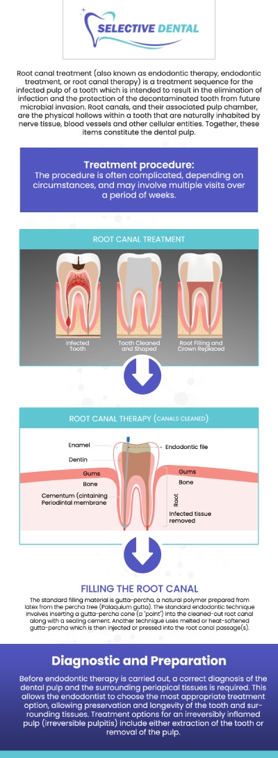 Common Questions Asked by Patients: Is it painful to get a root canal? Is a root canal a serious procedure? What happens during a root canal? A root canal treatment becomes necessary when there is inflammation or infection in the pulp chamber of a tooth. Visit Selective Dental to get quality and expert care. For more information, contact us today or schedule an appointment online. We are conveniently located at 3151 South White Road, Suite 203 San Jose, CA 95148. We serve patients from all over Santa Clara County CA: San Jose, Milpitas, Santa Clara, Campbell, Sunnyvale, Cupertino, Saratoga, Los Gatos CA, and beyond! Common Questions Asked by Patients: Is it painful to get a root canal? Is a root canal a serious procedure? What happens during a root canal?
A root canal treatment becomes necessary when there is inflammation or infection in the pulp chamber of a tooth. Visit Selective Dental to get quality and expert care. For more information, contact us today or schedule an appointment online. We are conveniently located at 3151 South White Road, Suite 203 San Jose, CA 95148. We serve patients from all over Santa Clara County CA: San Jose, Milpitas, Santa Clara, Campbell, Sunnyvale, Cupertino, Saratoga, Los Gatos CA, and beyond!